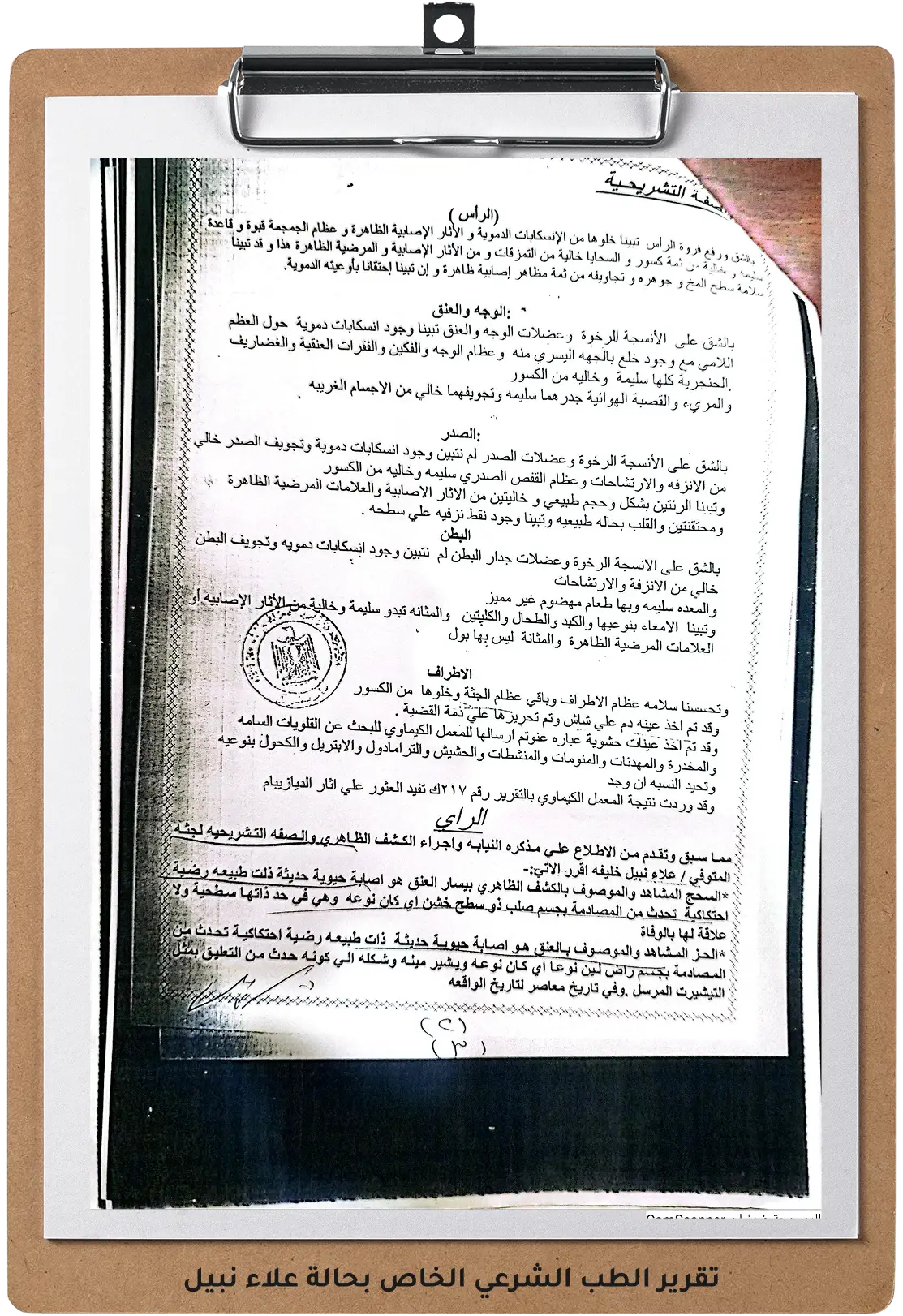 صورة للتقرير الطب الشرعي الخاص بحالة علاء نبيل