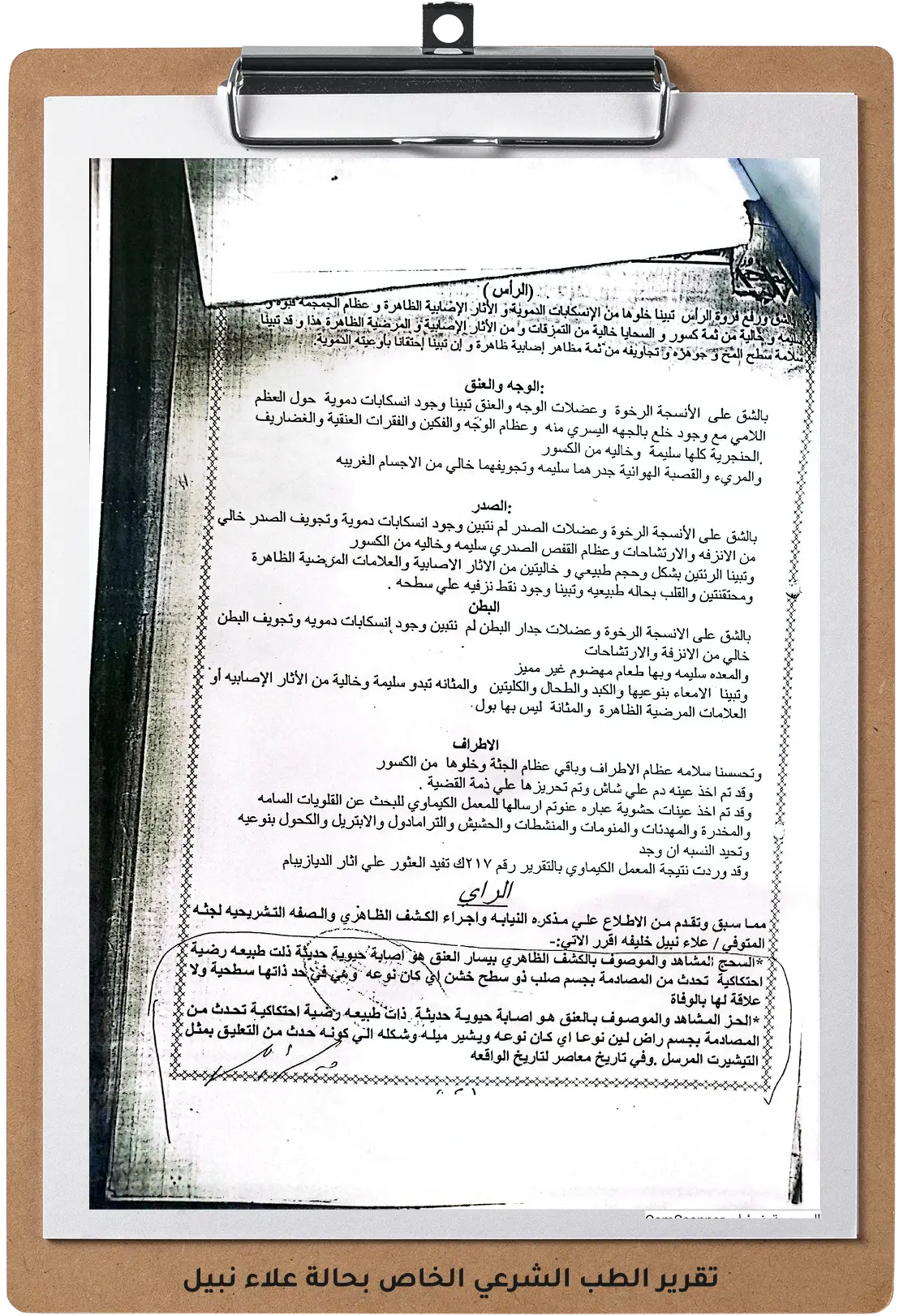 صورة للتقرير الطب الشرعي الخاص بحالة علاء نبيل صورة للتقرير الطب الشرعي الخاص بحالة علاء نبيل