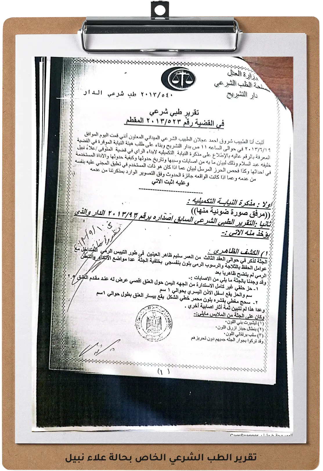 صورة للتقرير الطب الشرعي الخاص بحالة علاء نبيل صورة للتقرير الطب الشرعي الخاص بحالة علاء نبيل