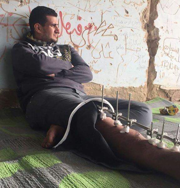 أحمد البديري بعد الإصابة