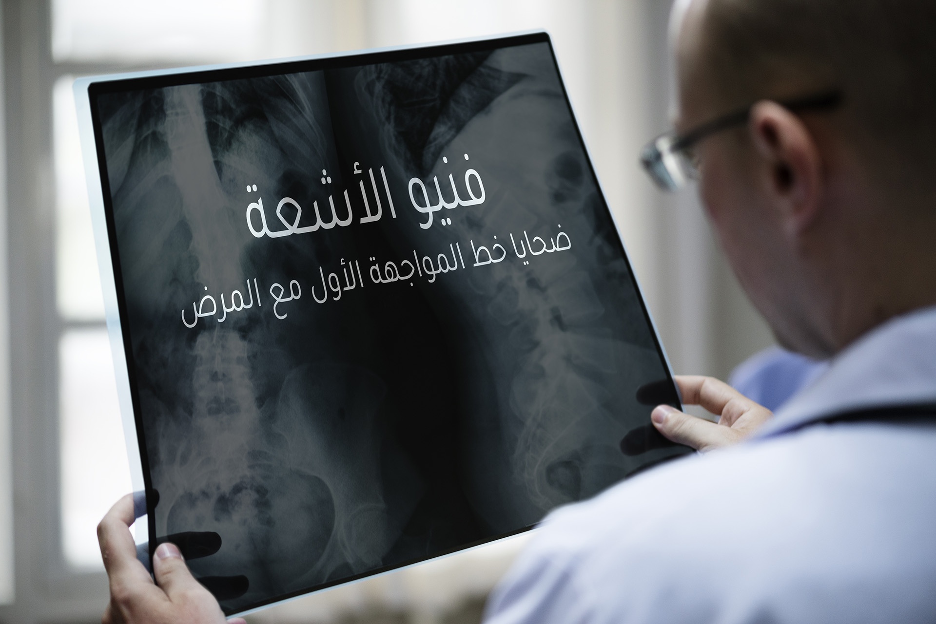 فنيو الأشعة ضحايا المواجهة الأولى مع المرض