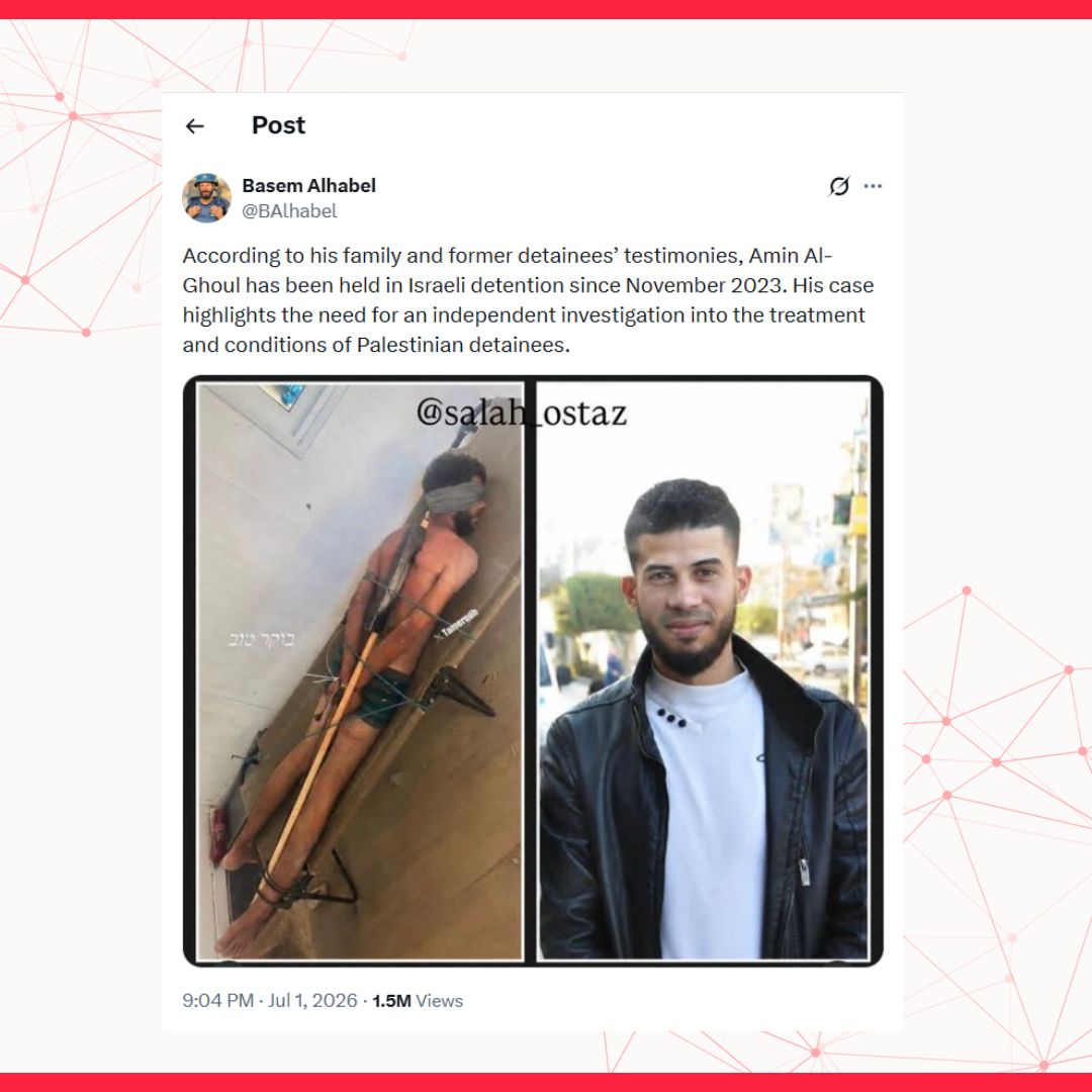 Image accompanying صورة أسير فلسطيني مكبل اليدين ومعصوب العينين تعرض للتعذيب مما أدى الى تشوهات في ساقه